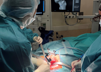 Hospital Ney Arias Lora realiza exitosa jornada quirúrgica de alta complejidad en reemplazo de rodilla y cadera